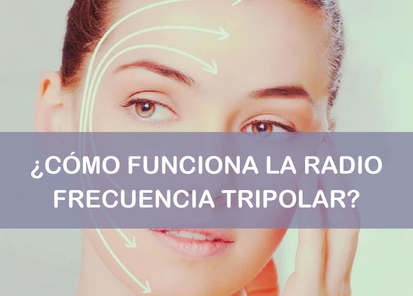 La radiofrecuencia tripolar cómo funciona