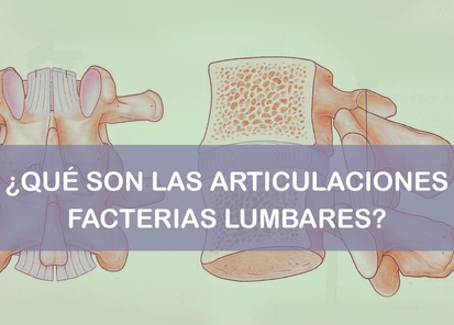 Las articulaciones facetarias lumbares qué son