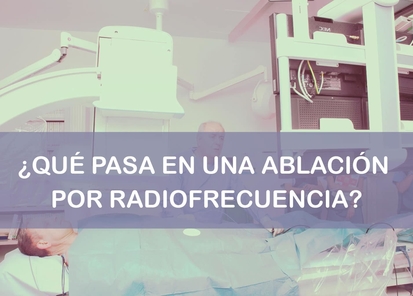 Qué pasa durante una ablación por radiofrecuencia
